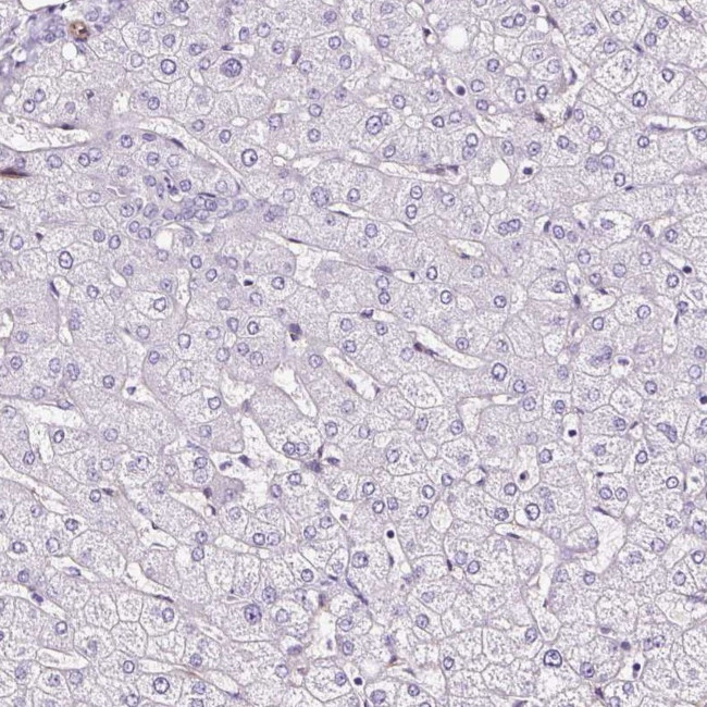 SLC7A8 Antibody in Immunohistochemistry (IHC)