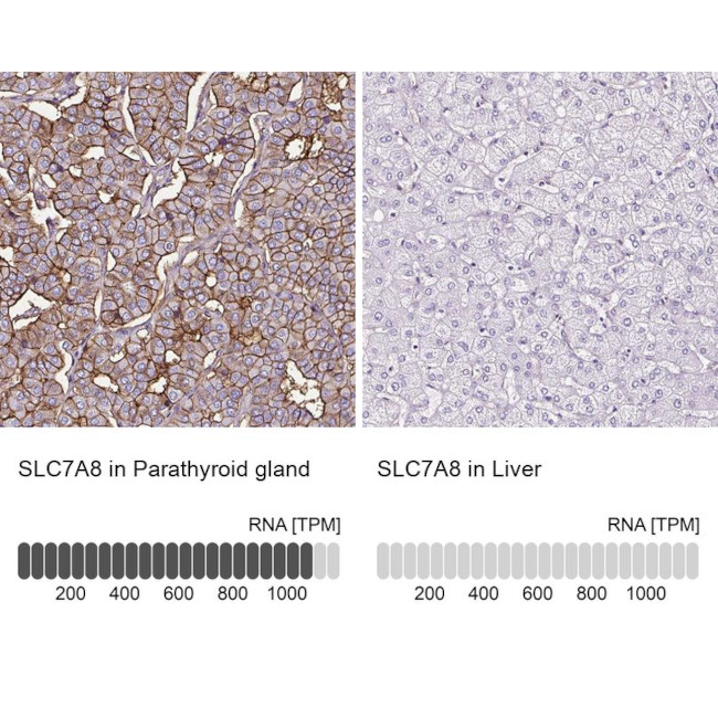 SLC7A8 Antibody