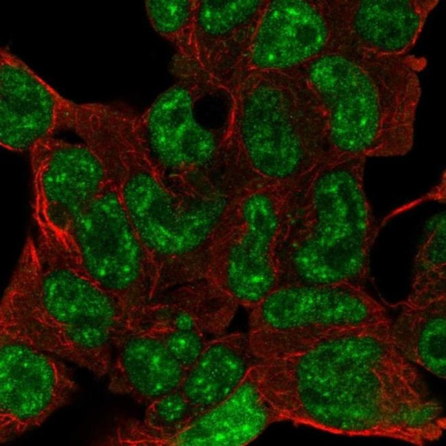 ESX1 Antibody in Immunocytochemistry (ICC/IF)