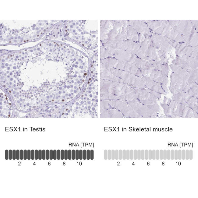 ESX1 Antibody in Immunohistochemistry (IHC)