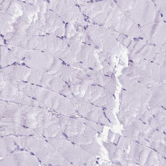 ESX1 Antibody in Immunohistochemistry (IHC)