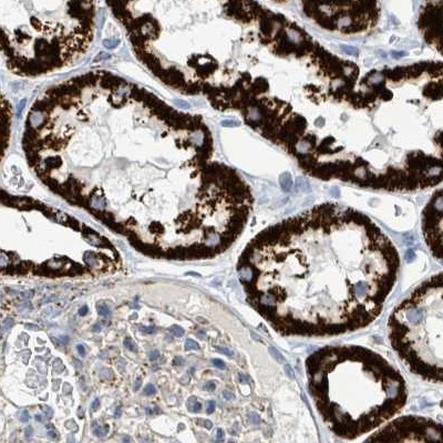 SUCLG2 Antibody in Immunohistochemistry (IHC)