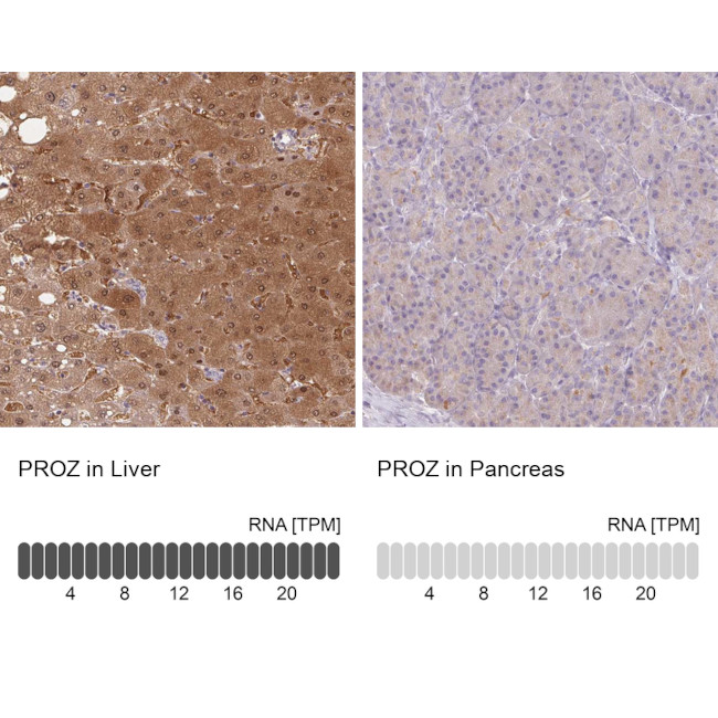 Protein Z Antibody in Immunohistochemistry (IHC)