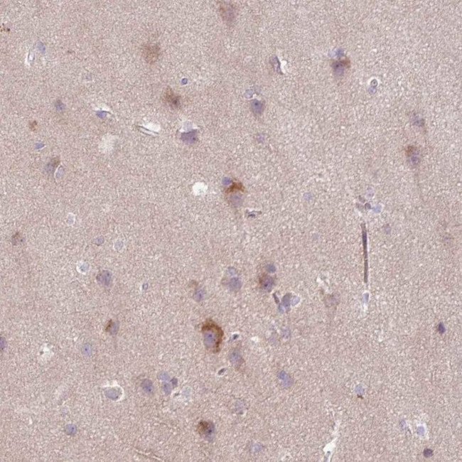 GEFT Antibody in Immunohistochemistry (IHC)