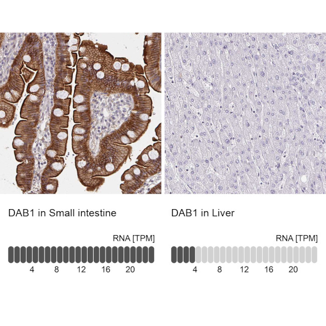 DAB1 Antibody in Immunohistochemistry (IHC)