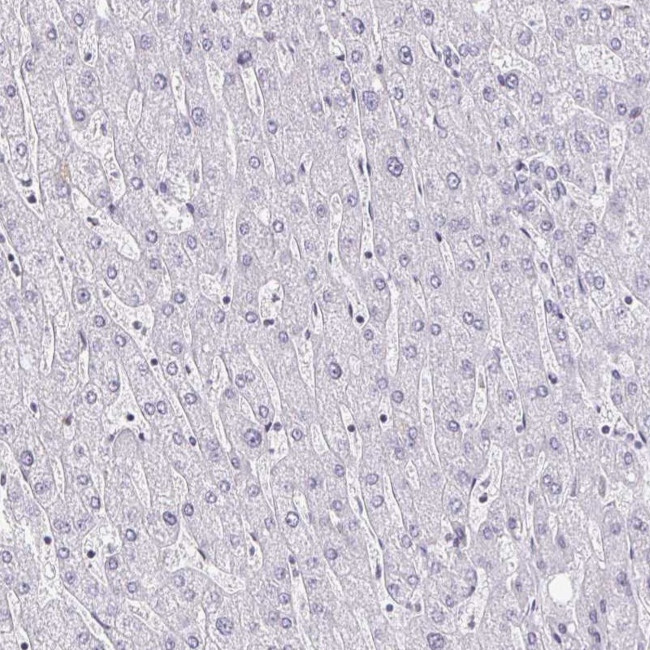 DAB1 Antibody in Immunohistochemistry (IHC)