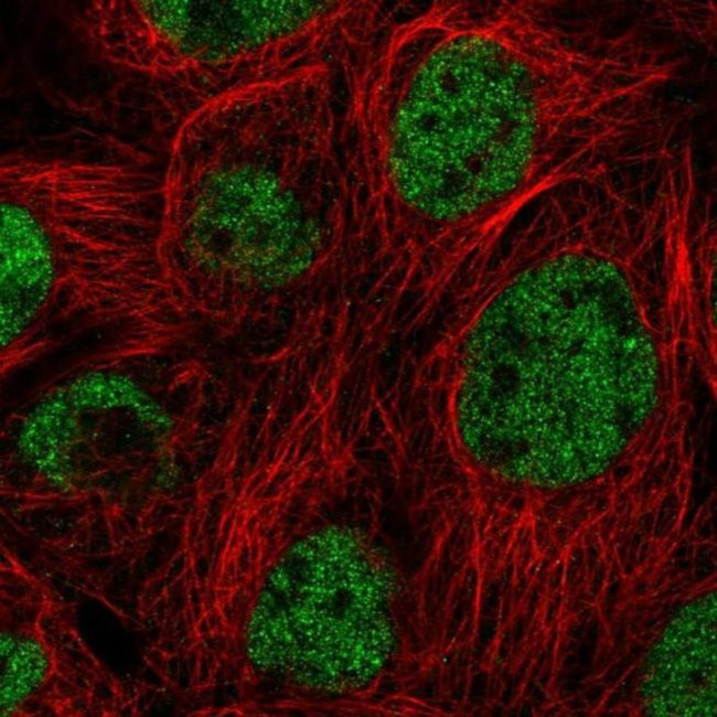 KCTD11 Antibody in Immunocytochemistry (ICC/IF)