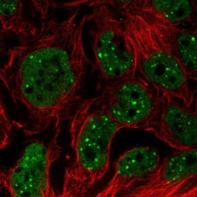 C17orf51 Antibody in Immunocytochemistry (ICC/IF)