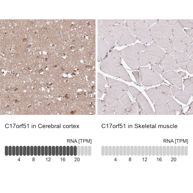 C17orf51 Antibody in Immunohistochemistry (IHC)