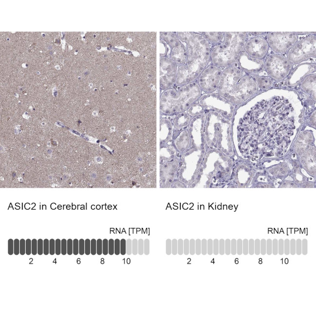 ASIC2 Antibody