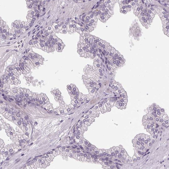 KBTBD5 Antibody in Immunohistochemistry (IHC)