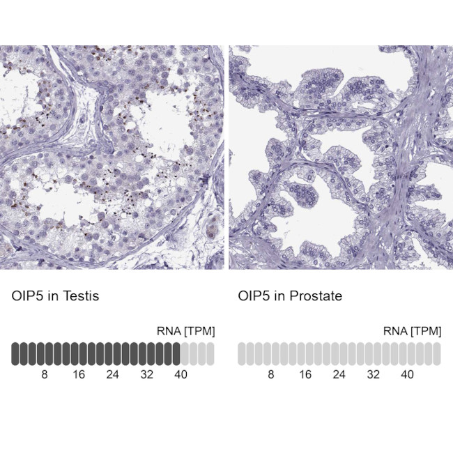 OIP5 Antibody in Immunohistochemistry (IHC)