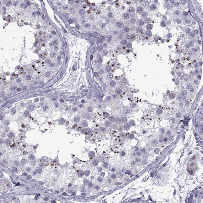 OIP5 Antibody in Immunohistochemistry (IHC)