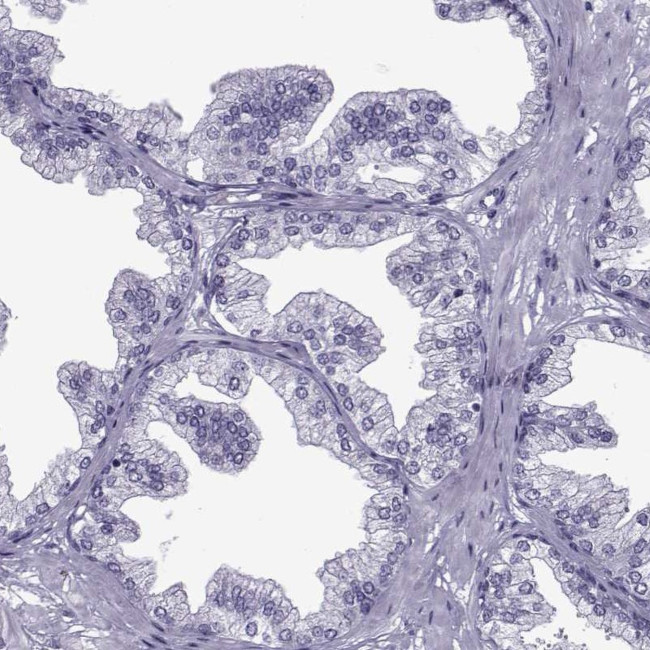 OIP5 Antibody in Immunohistochemistry (IHC)