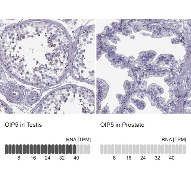 OIP5 Antibody