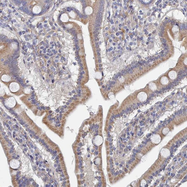 G6PC Antibody in Immunohistochemistry (IHC)