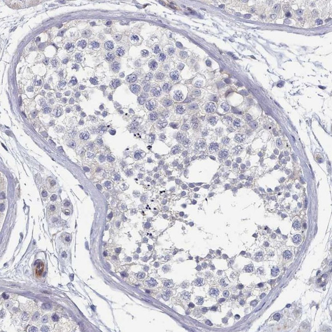 G6PC Antibody in Immunohistochemistry (IHC)