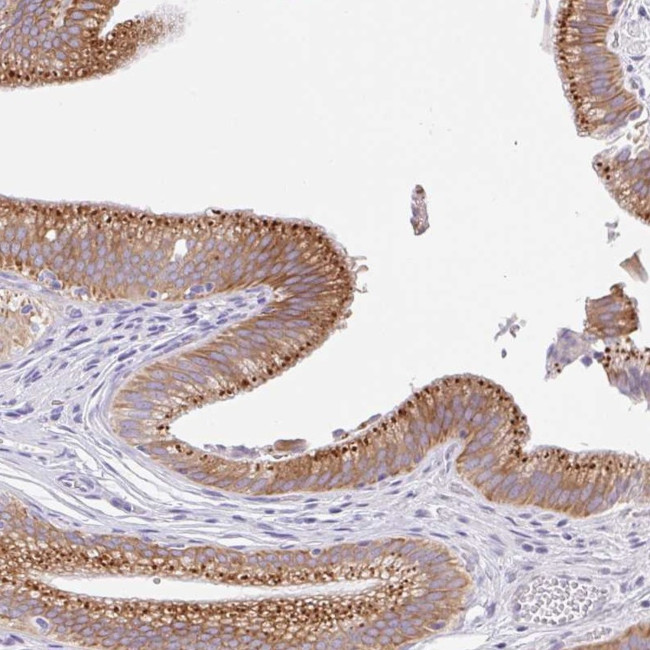 TRAF4 Antibody in Immunohistochemistry (IHC)