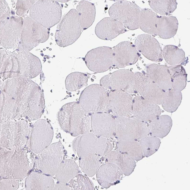 TRAF4 Antibody in Immunohistochemistry (IHC)