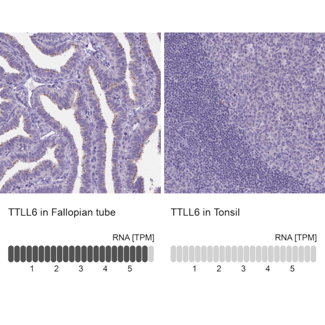 TTLL6 Antibody in Immunohistochemistry (IHC)