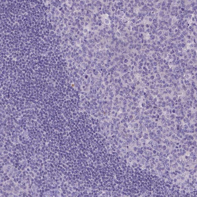 TTLL6 Antibody in Immunohistochemistry (IHC)