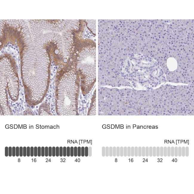 GSDMB Antibody in Immunohistochemistry (IHC)