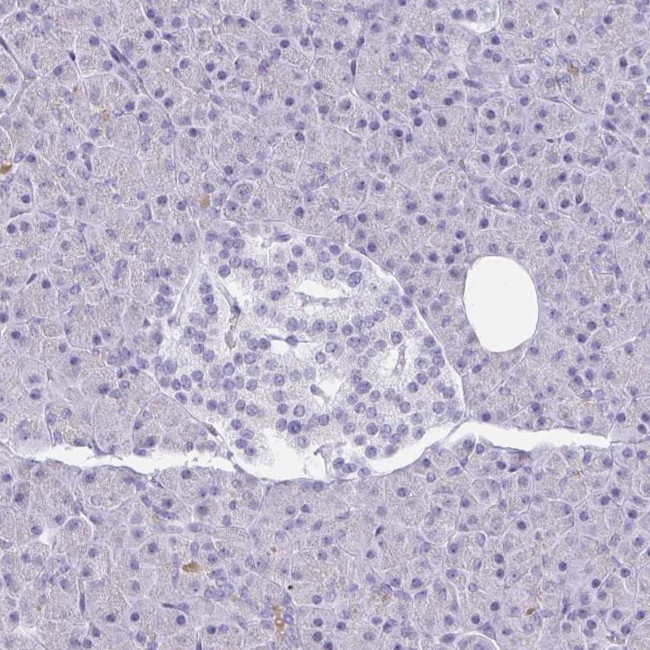 GSDMB Antibody in Immunohistochemistry (IHC)