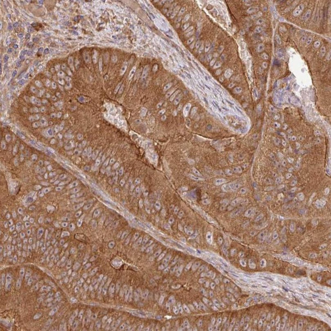 GSPT1 Antibody in Immunohistochemistry (IHC)