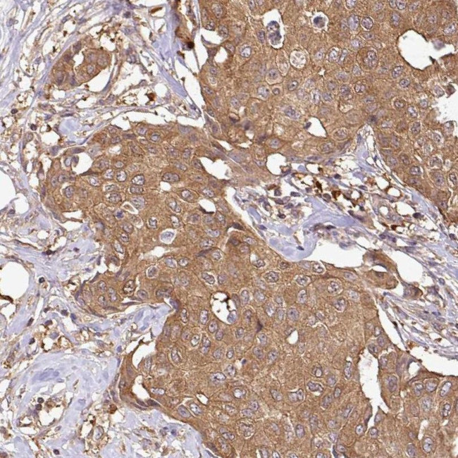 GSPT1 Antibody in Immunohistochemistry (IHC)