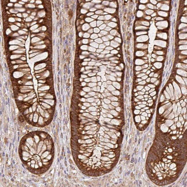 GSPT1 Antibody in Immunohistochemistry (IHC)