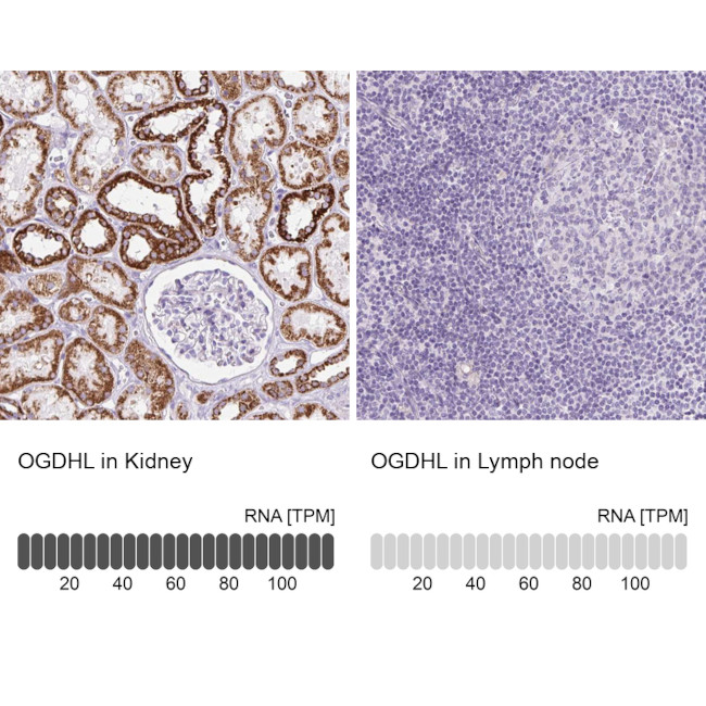 OGDHL Antibody in Immunohistochemistry (IHC)