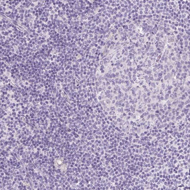 OGDHL Antibody in Immunohistochemistry (IHC)