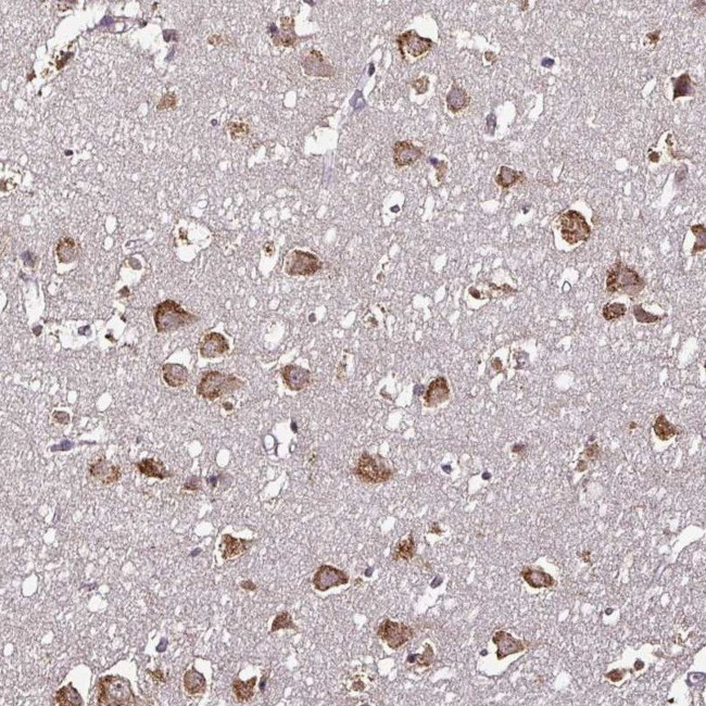 RPL38 Antibody in Immunohistochemistry (IHC)