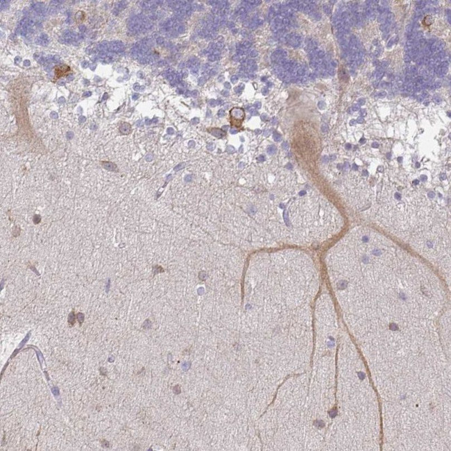 WSB2 Antibody in Immunohistochemistry (IHC)