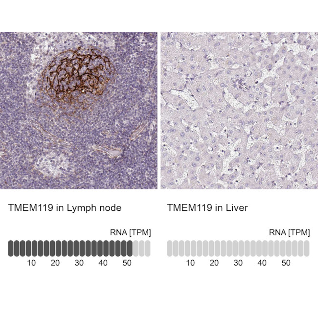 TMEM119 Antibody in Immunohistochemistry (IHC)