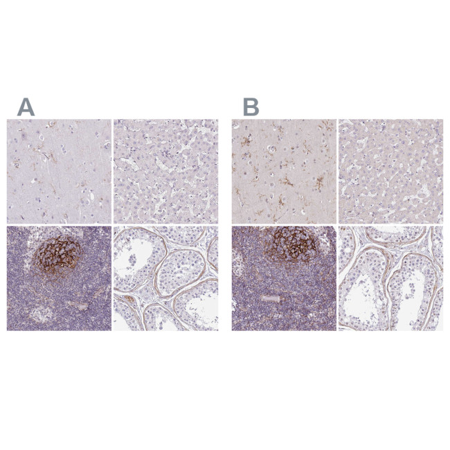 TMEM119 Antibody in Immunohistochemistry (IHC)