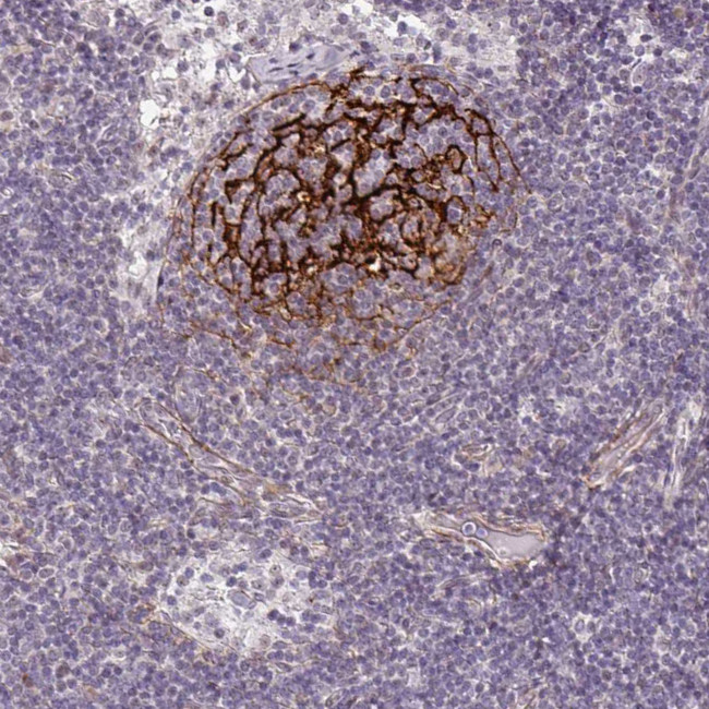 TMEM119 Antibody in Immunohistochemistry (IHC)