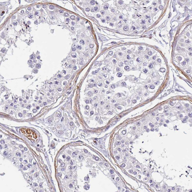 TMEM119 Antibody in Immunohistochemistry (IHC)