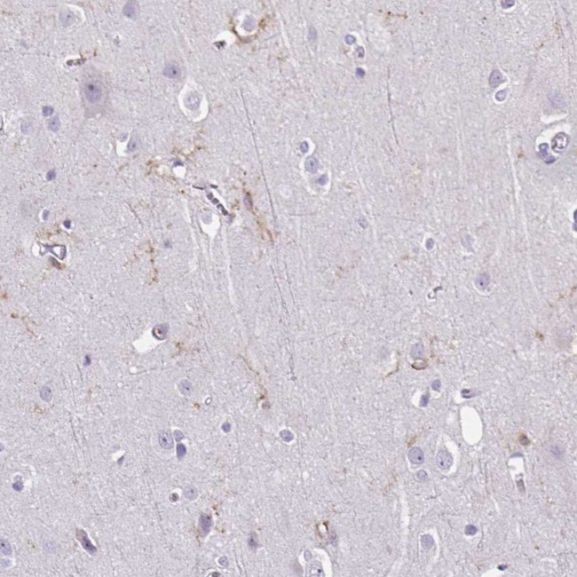 TMEM119 Antibody in Immunohistochemistry (IHC)