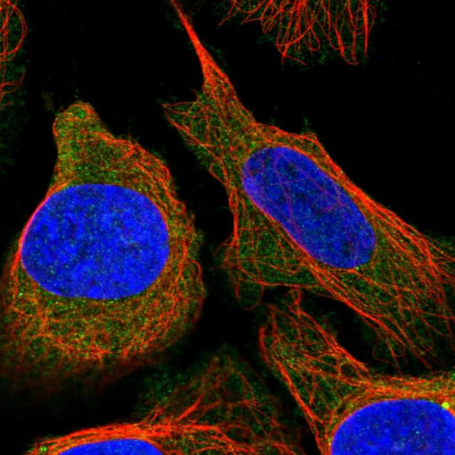 TBC1D2B Antibody in Immunocytochemistry (ICC/IF)