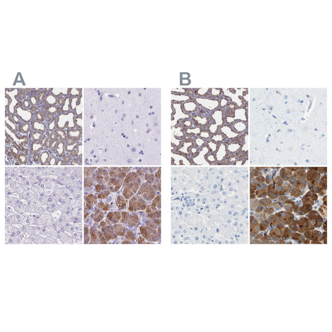 CEL Antibody in Immunohistochemistry (IHC)