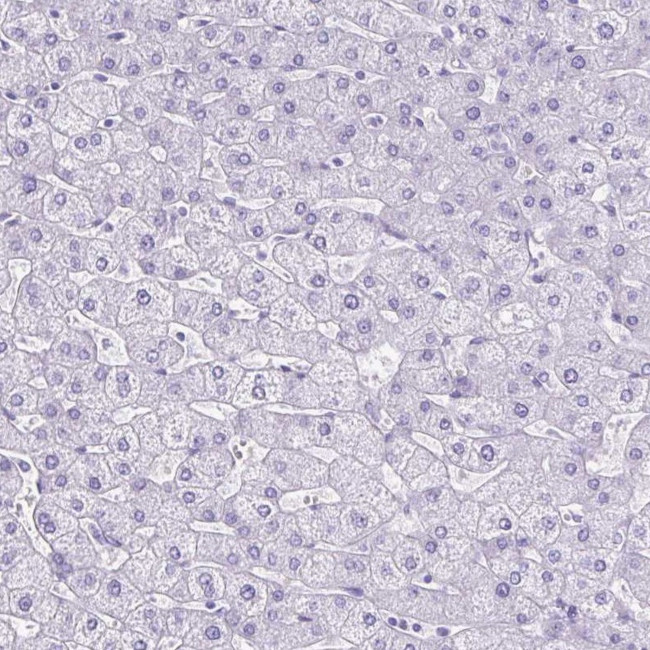 CEL Antibody in Immunohistochemistry (IHC)