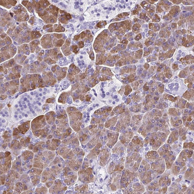 CEL Antibody in Immunohistochemistry (IHC)