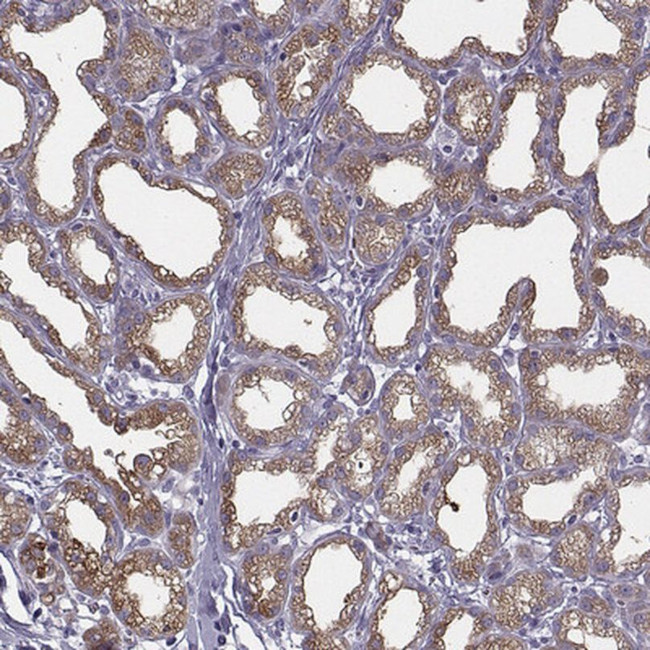 CEL Antibody in Immunohistochemistry (IHC)