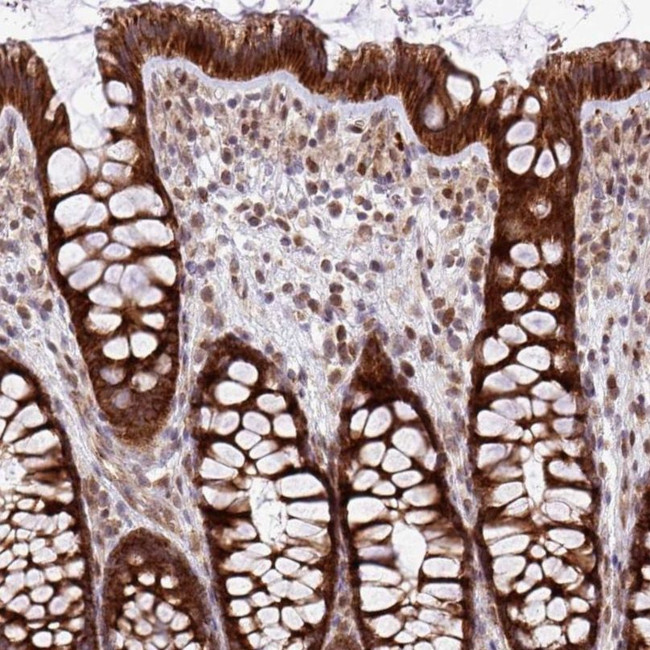 B3GNT9 Antibody in Immunohistochemistry (IHC)