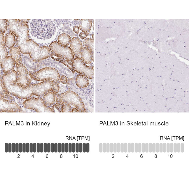 PALM3 Antibody in Immunohistochemistry (IHC)