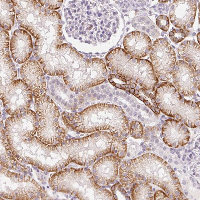 PALM3 Antibody in Immunohistochemistry (IHC)