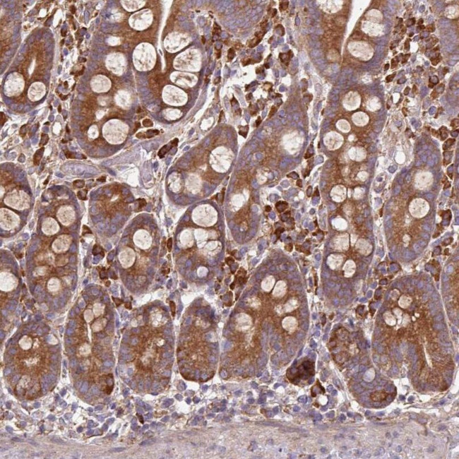 FAT4 Antibody in Immunohistochemistry (IHC)