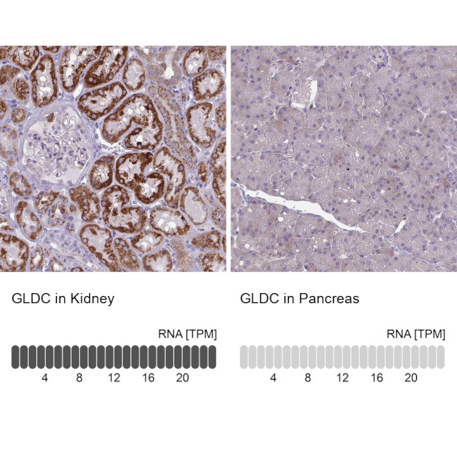 GLDC Antibody in Immunohistochemistry (IHC)