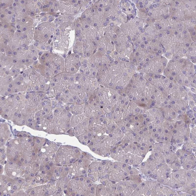 GLDC Antibody in Immunohistochemistry (IHC)